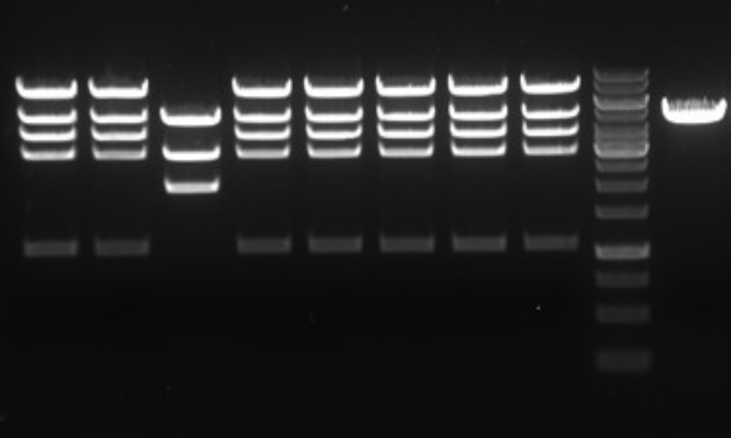 Agarose gel electrophoresis