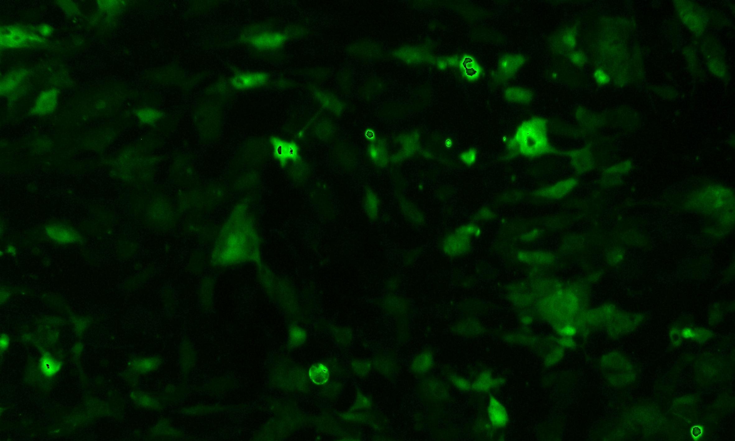 Cells with GFP reporter selection