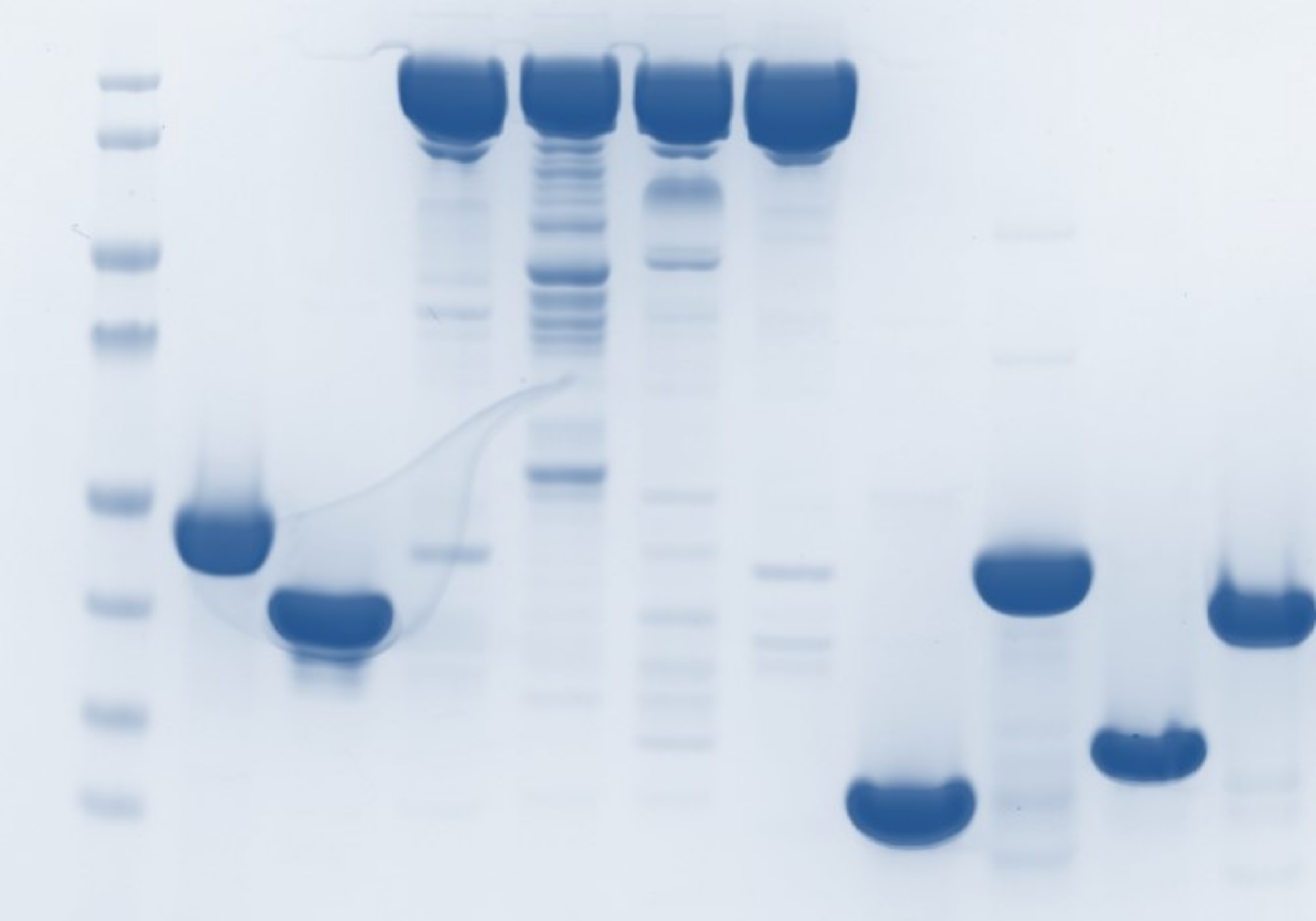 Coomassie stained SDS-PAGE gel